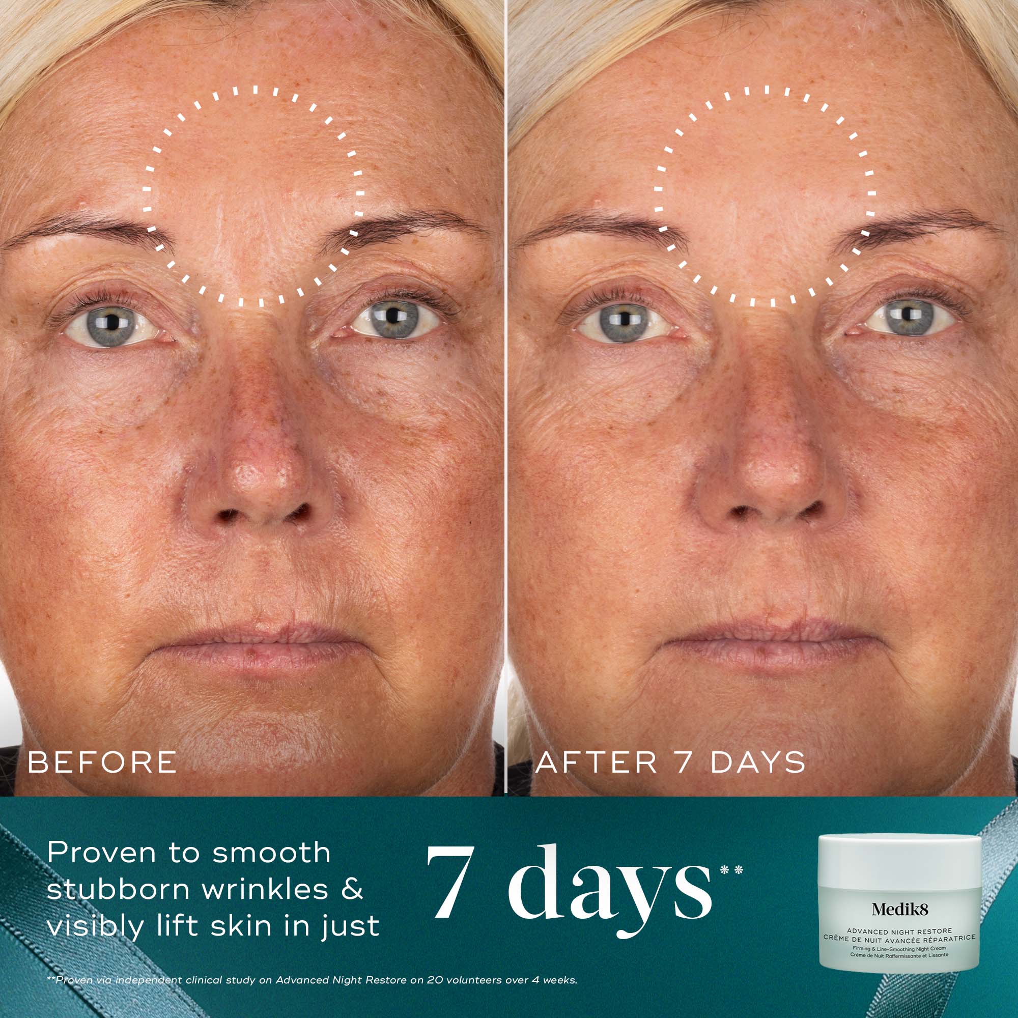 Medik8 - Moisture Minis Kit