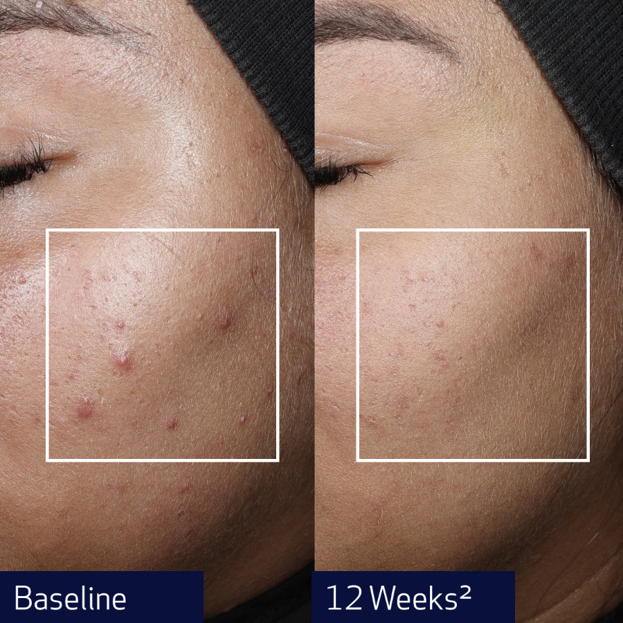TRAVEL - OBAGI Nu-Gen Cellular Renewal Serum 10ml